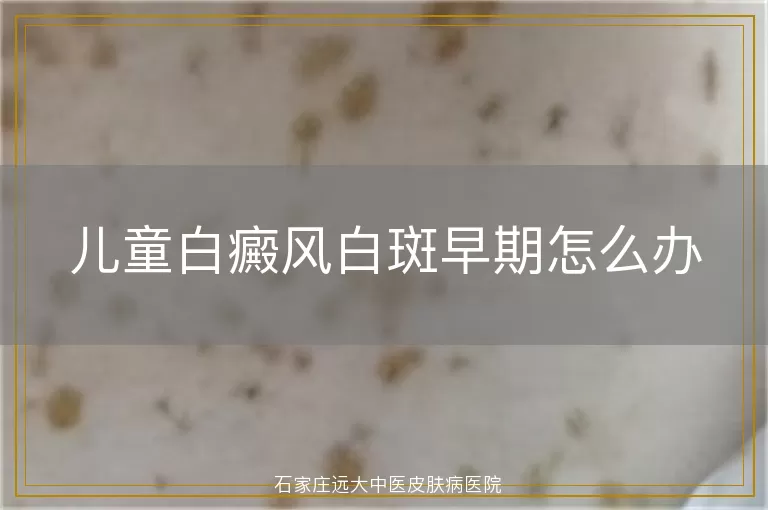 儿童白癜风白斑早期怎么办