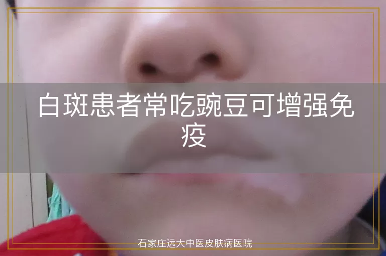 白斑患者常吃豌豆可增强免疫