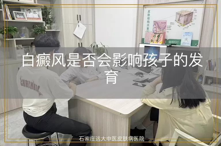 白癜风是否会影响孩子的发育
