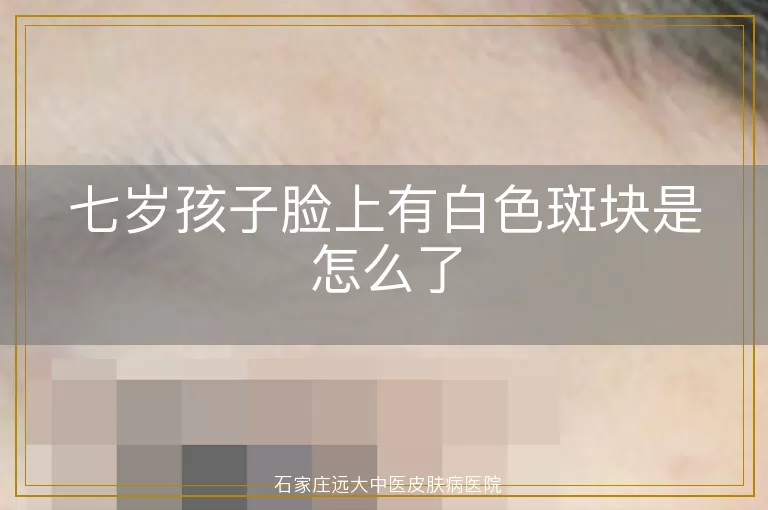 七岁孩子脸上有白色斑块是怎么了
