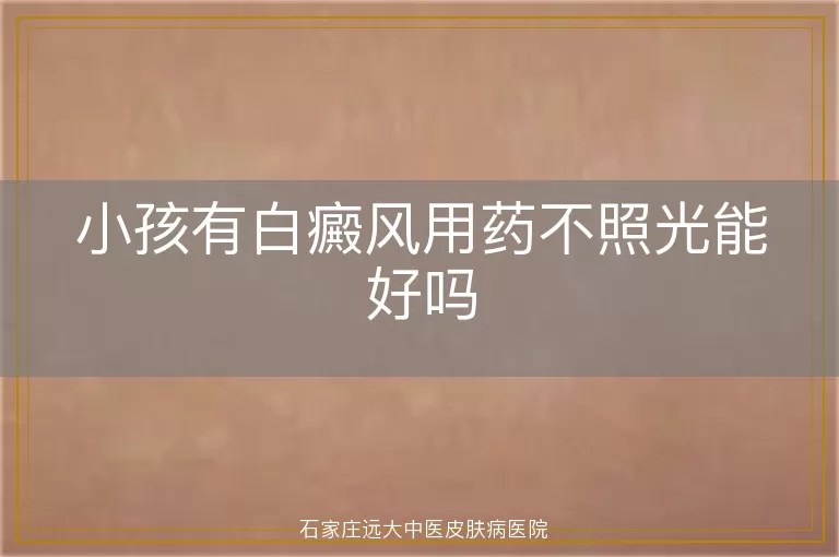 小孩有白癜风用药不照光能好吗