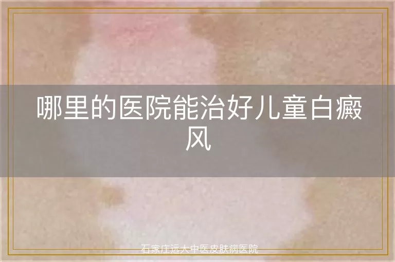 哪里的医院能治好儿童白癜风