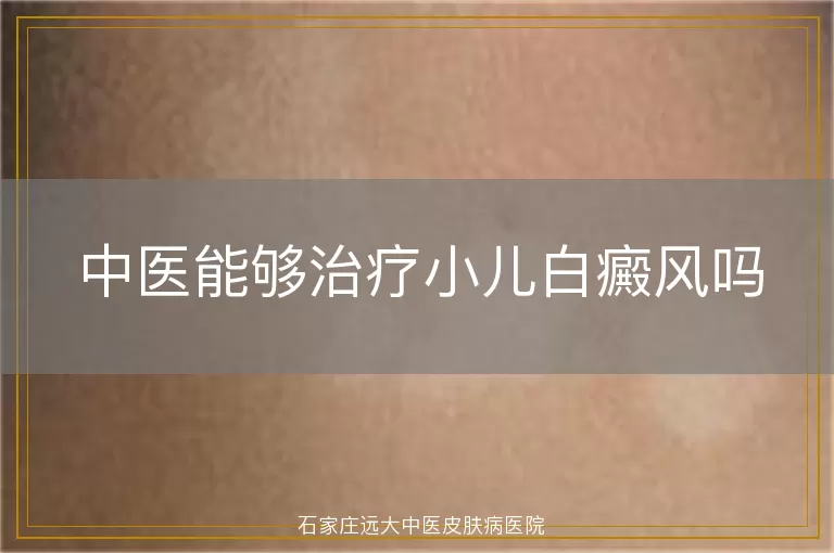 中医能够治疗小儿白癜风吗