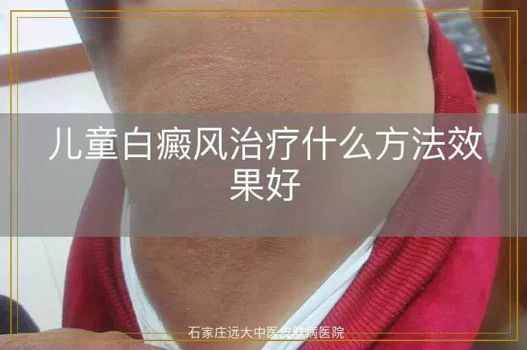 儿童白癜风治疗什么方法效果好