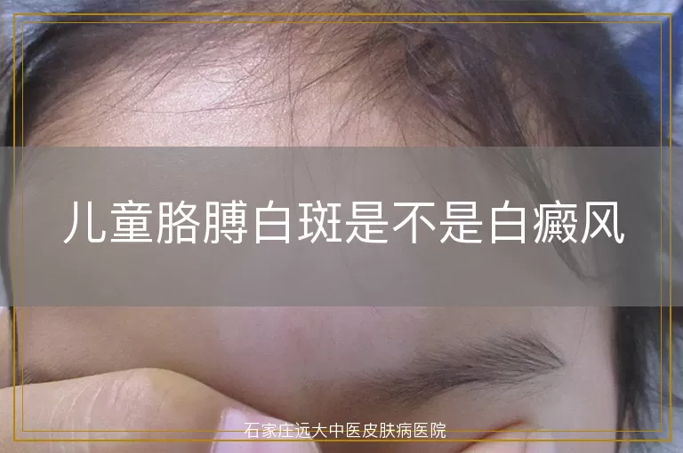 儿童胳膊白斑是不是白癜风