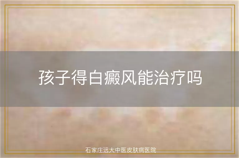 孩子得白癜风能治疗吗