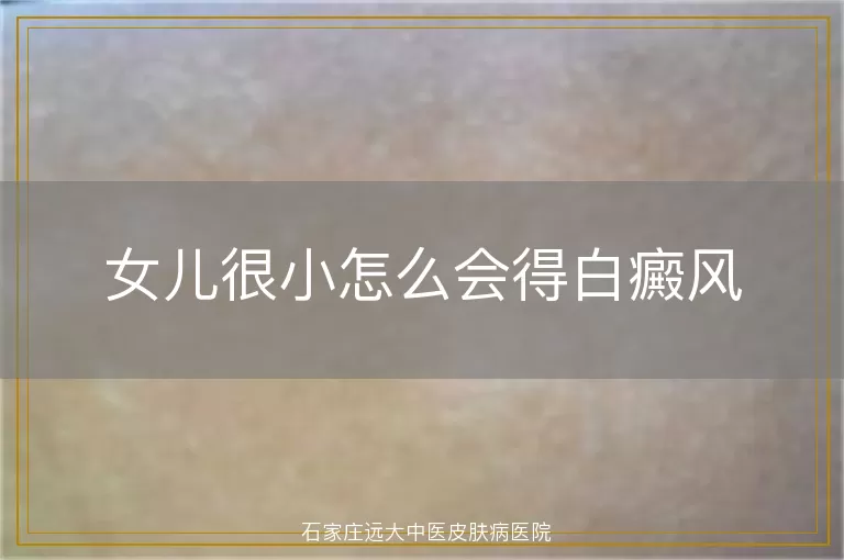 女儿很小怎么会得白癜风
