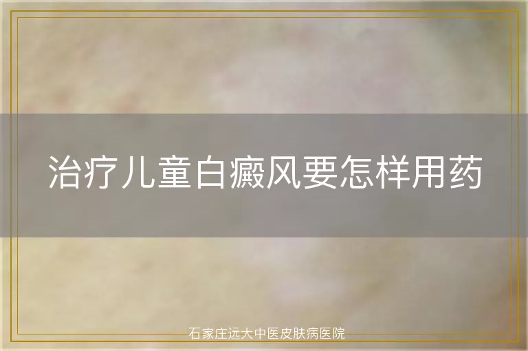 治疗儿童白癜风要怎样用药