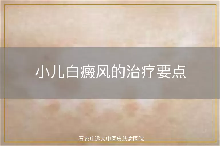 小儿白癜风的治疗要点