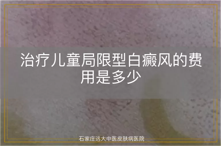 治疗儿童局限型白癜风的费用是多少