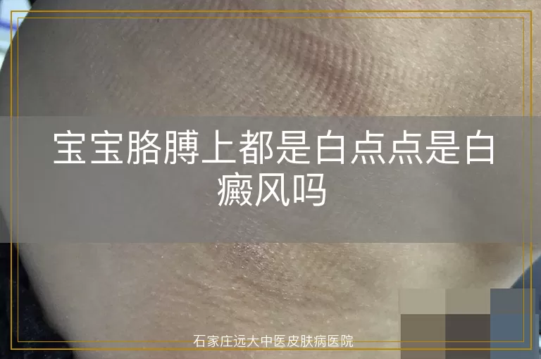 宝宝胳膊上都是白点点是白癜风吗