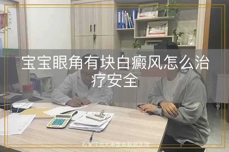 宝宝眼角有块白癜风怎么治疗安全