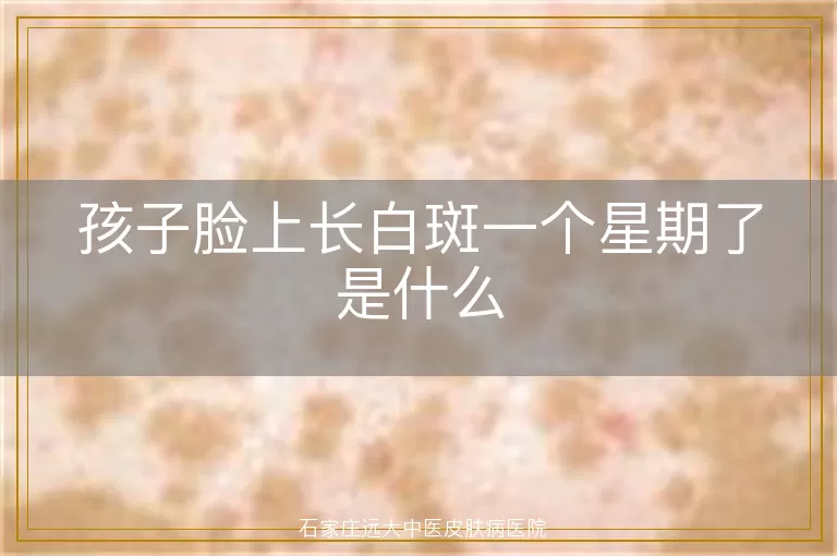 孩子脸上长白斑一个星期了是什么