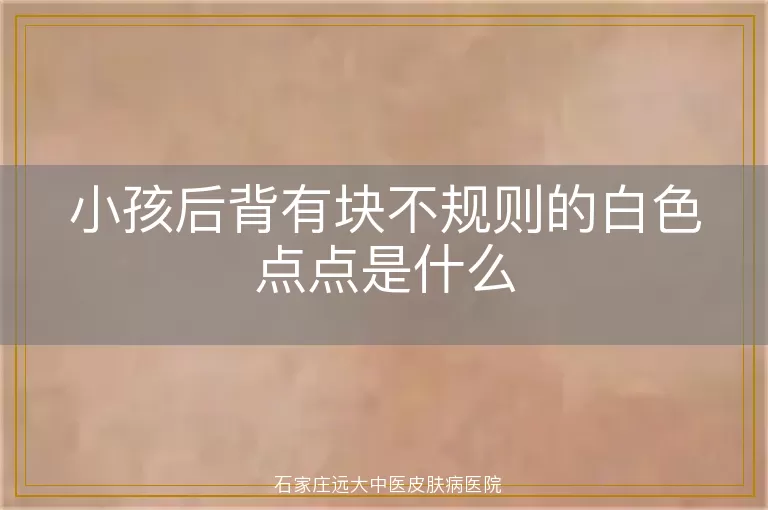 小孩后背有块不规则的白色点点是什么