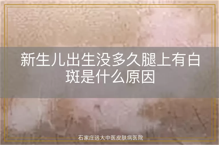 新生儿出生没多久腿上有白斑是什么原因
