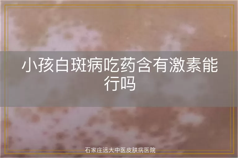 小孩白斑病吃药含有激素能行吗