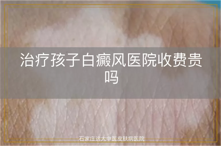 治疗孩子白癜风医院收费贵吗