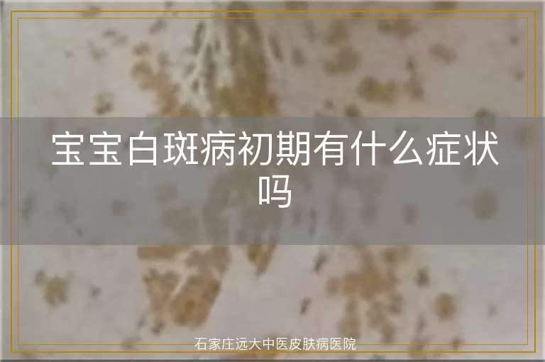 宝宝白斑病初期有什么症状吗