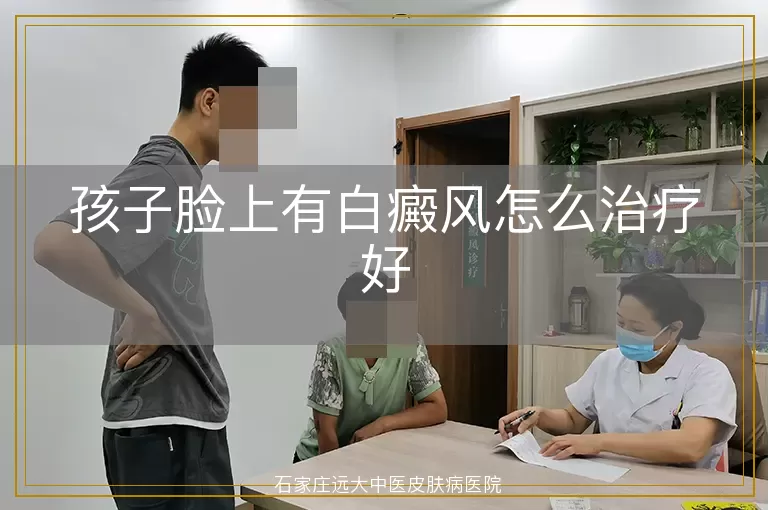 孩子脸上有白癜风怎么治疗好