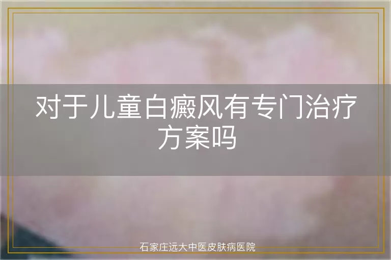 对于儿童白癜风有专门治疗方案吗