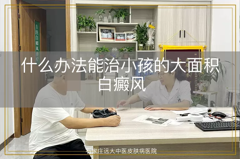 什么办法能治小孩的大面积白癜风
