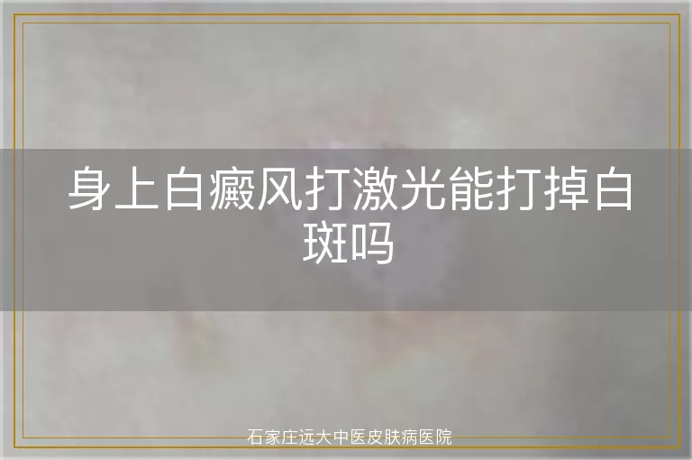 身上白癜风打激光能打掉白斑吗