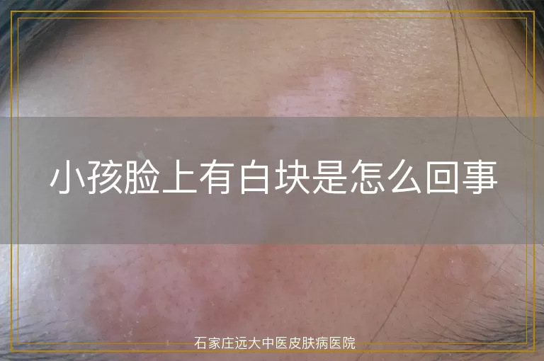 小孩脸上有白块是怎么回事