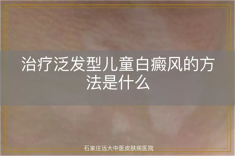 治疗泛发型儿童白癜风的方法是什么