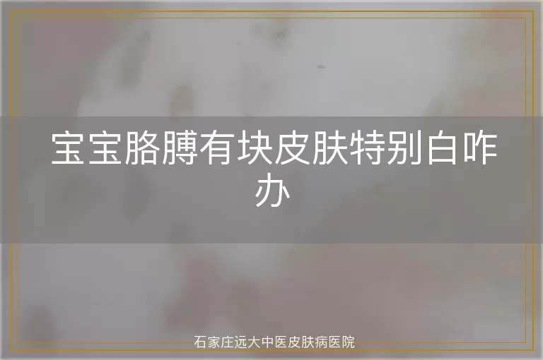 宝宝胳膊有块皮肤特别白咋办