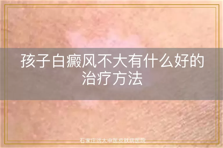 孩子白癜风不大有什么好的治疗方法