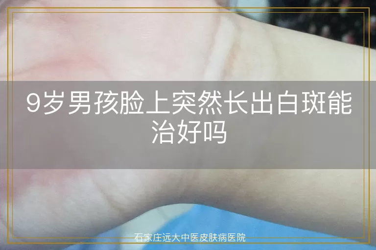 9岁男孩脸上突然长出白斑能治好吗