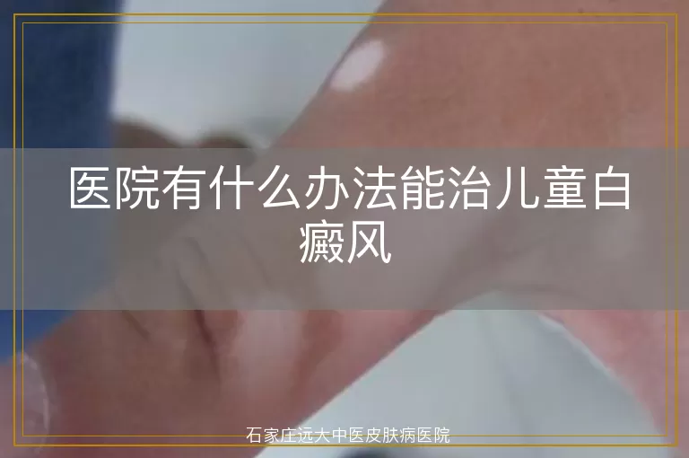 医院有什么办法能治儿童白癜风