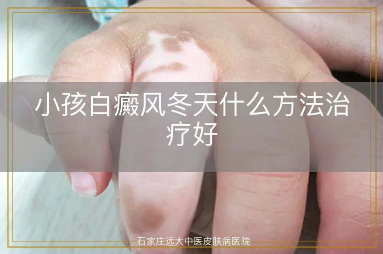 小孩白癜风冬天什么方法治疗好