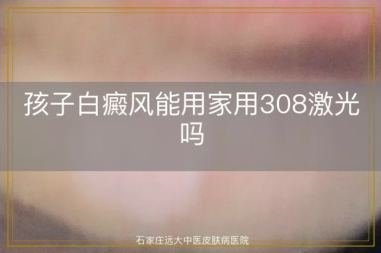 孩子白癜风能用家用308激光吗