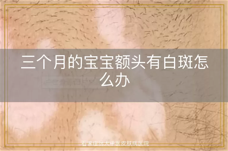 三个月的宝宝额头有白斑怎么办