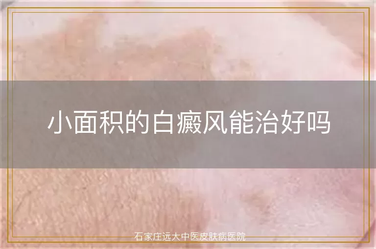 小面积的白癜风能治好吗
