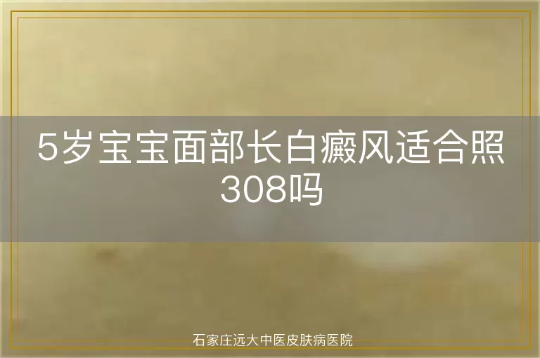 5岁宝宝面部长白癜风适合照308吗