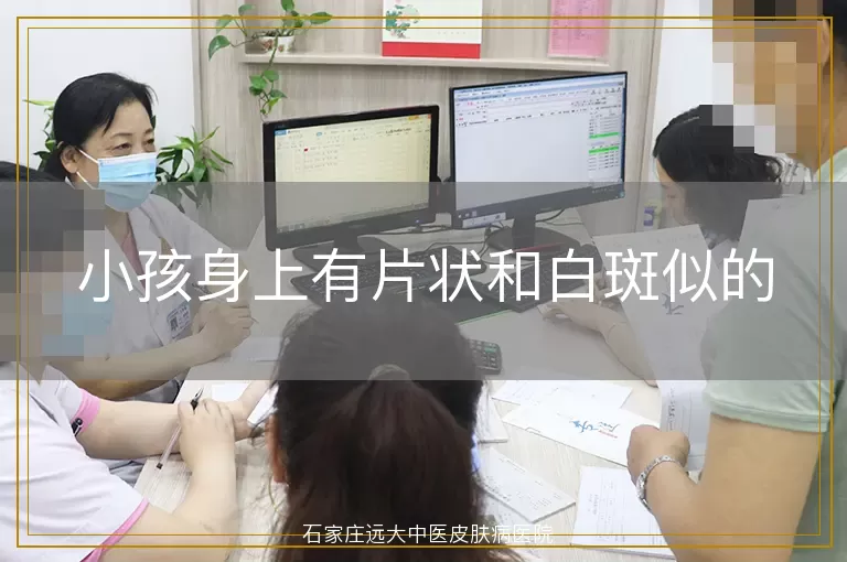 小孩身上有片状和白斑似的