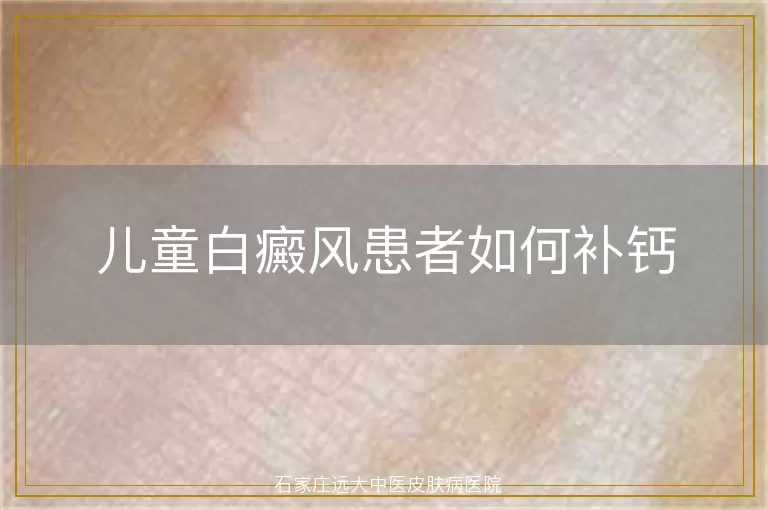 儿童白癜风患者如何补钙