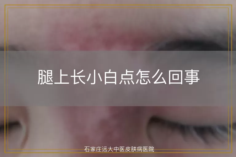 腿上长小白点怎么回事
