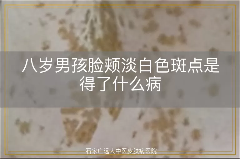八岁男孩脸颊淡白色斑点是得了什么病