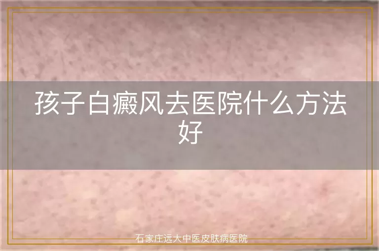 孩子白癜风去医院什么方法好
