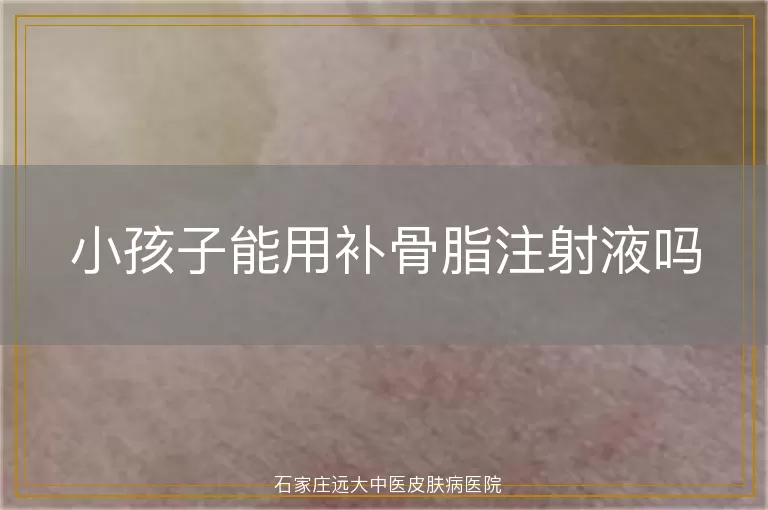 小孩子能用补骨脂注射液吗