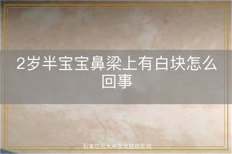 2岁半宝宝鼻梁上有白块怎么回事