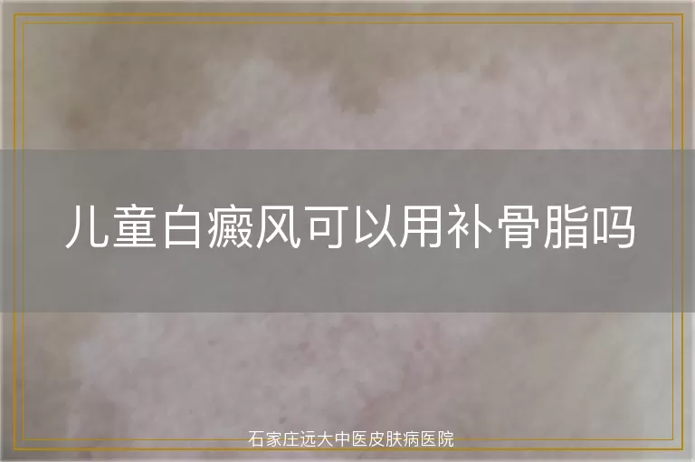 儿童白癜风可以用补骨脂吗