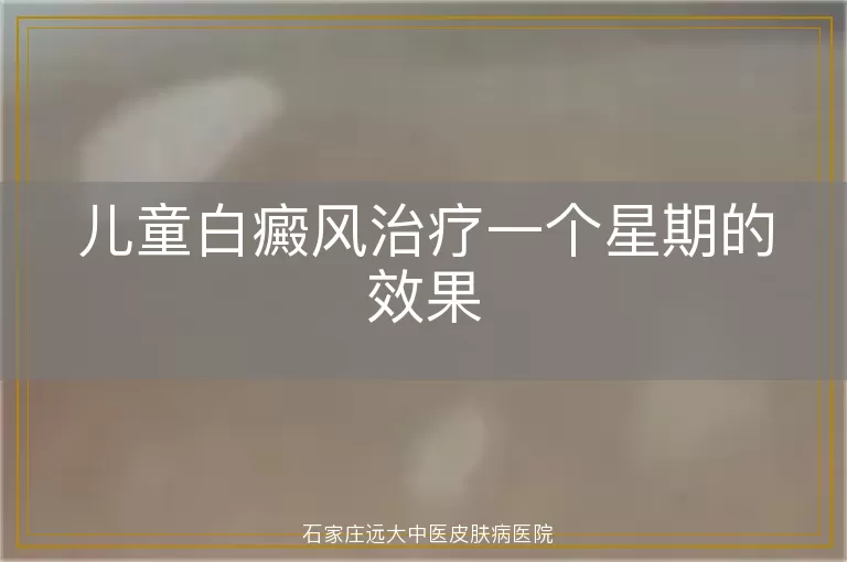 儿童白癜风治疗一个星期的效果