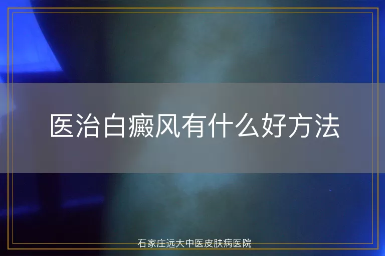 医治白癜风有什么好方法