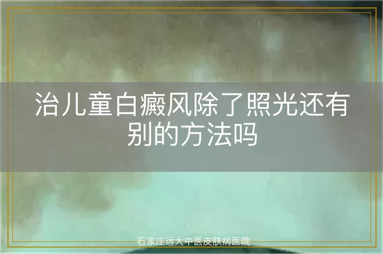 治儿童白癜风除了照光还有别的方法吗