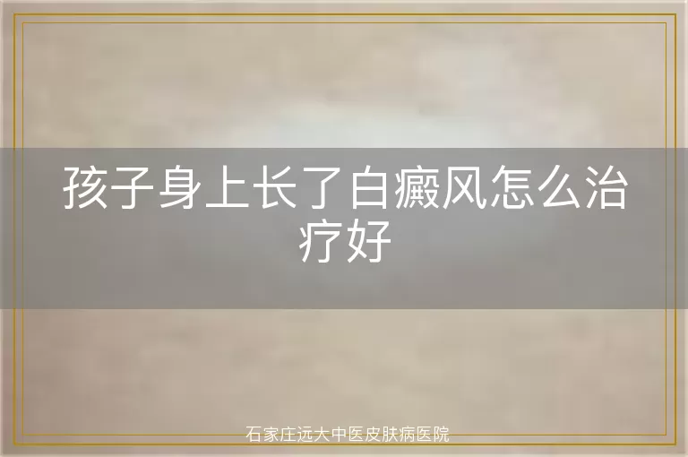 孩子身上长了白癜风怎么治疗好