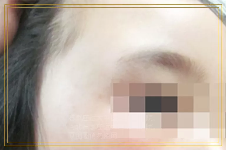 孩子遗传的白癜风可以治好吗